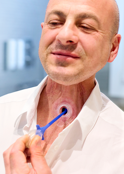 voice-prosthesis-longevity-webinar
